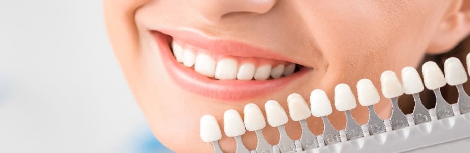 Cosmetic Dental Services in Calgary
